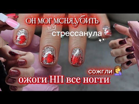 I got stressed out/Burnt all my nails🤦‍♀️/Wasted money/Disappointment/I want an iPhone/December 1...