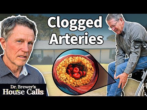 Clogged Arteries Destroyed His Life... Until THIS Happened
