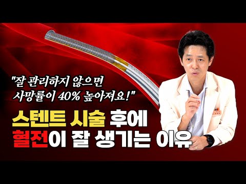 스텐트 시술 후 관리 feat. 아스피린 관련 질문 모음 | 삼성서울병원 송영빈 교수