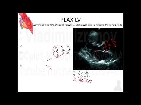 ЭхоКГ  Аккредсценарий №1  Введение  Часть 2