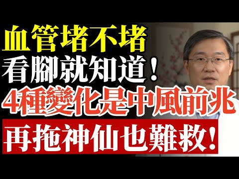 血管通不通，看腳就知道！腳有這4種變化，恐是中風、心肌梗塞前兆，再拖神仙也難救！#心血管疾病#腦中風前兆#血管阻塞#靜脈血栓#糖尿病足 #下肢動脈硬化 #血液循環 #手腳冰冷 #中老年養生 #消除血栓