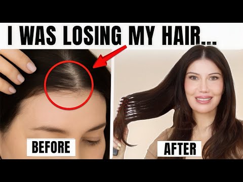 I Was Losing My Hair… Until I Did This