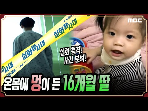 [실화충격] 온몸에 멍이 든 16개월 딸 #실화탐사대 #실화On MBC190417방송