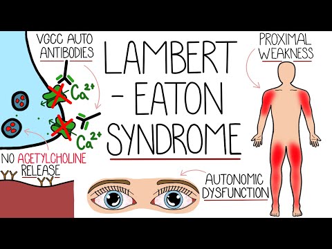 Understanding Lambert-Eaton Myasthenic Syndrome (LEMS Explained)