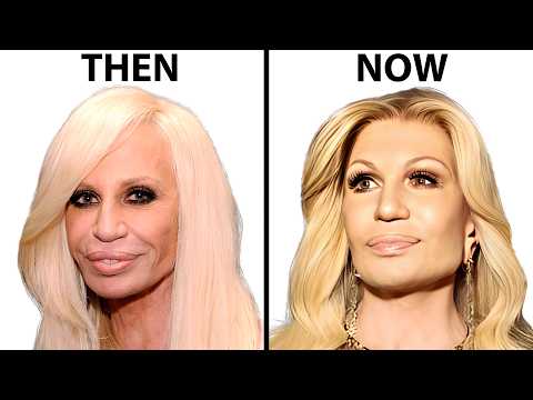 Donatella Versace's NEW FACE | Plastic Surgery Analysis