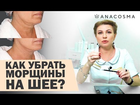 🔥Убрать морщины на шее 🔥 Кольца Венеры на шее🔥Тяжи на шее! - Хусид Ольга Владимировна