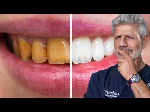 7 Tips for White Teeth