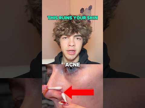 Why your phone is giving you acne 😱