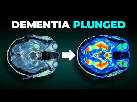 Dementia Rates PLUNGED in Study of 1 Million People