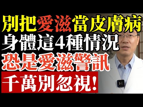 別把愛滋當皮膚病！ 身體這4種情況，恐是病毒警訊，千萬別忽視！#愛滋病 #皮膚警訊 #免疫系統 #中老年健康 #養生 #健康檢查 #預防醫學 #癌症 #兩性健康 #醫療保健