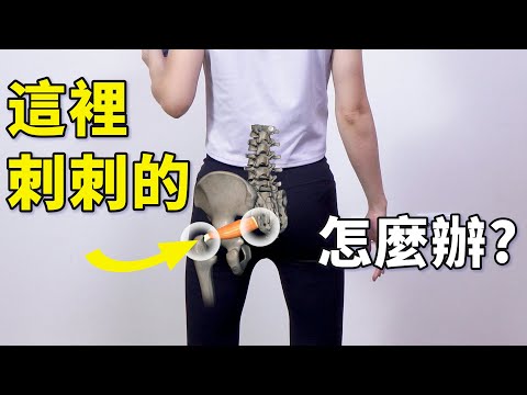 The Origin of Sciatica - Piriformis Syndrome: 7 Exercises to Alleviate Deep Gluteal Pain