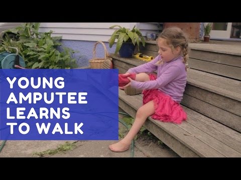 Young amputee learns to walk
