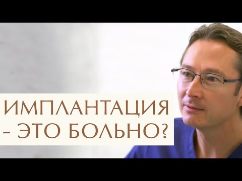 😊 Стоматолог о том, что нужно знать об имплантации зубов. Имплантация зубов что нужно знать. 12+
