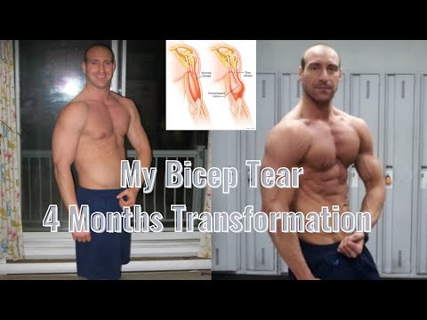 Bicep Tear Recovery: How I Got Back In Top Shape After 4 Months