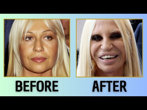 40+ HOLLYWOOD STARS BEFORE & AFTER PLASTIC SURGERY | UNBELIEVABLE TRANSFORMATIONS!