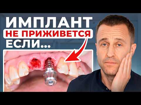 90% of people experience this after implantation! These are the most common complaints after impl...