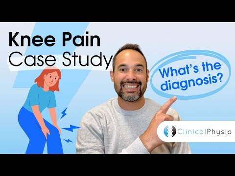 Knee Pain Case Study | Expert Physio Review