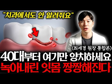 "괜히 비싼 돈 쓰지 마세요" 약국에서 단돈 2000원으로 녹아내린 잇몸병 싹 사라집니다 (최세경 원장 통합본)