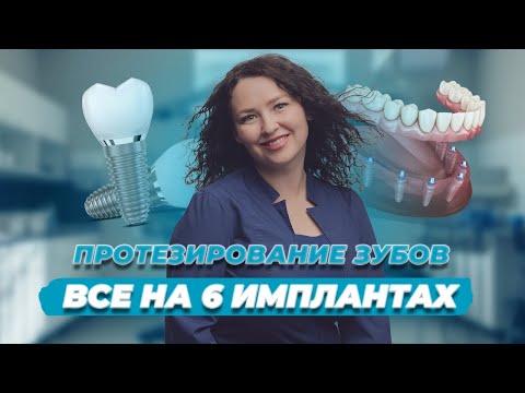 Нет зубов? Все зубы разрушены? Все об имплантации "ВСЕ НА 6". Стоматология Вариант в Самаре