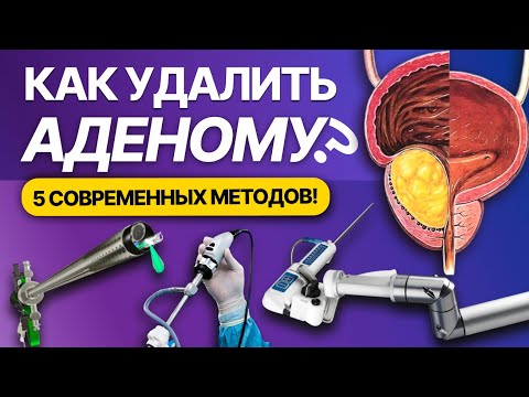 Large Prostate Adenoma: Five Effective Removal Methods. Complications, Advantages, and Disadvantages