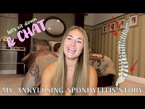 Diagnosed with a Chronic Autoimmune Disease | My Ankylosing Spondylitis Story