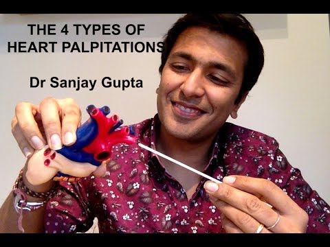 The 4 types of heart palpitations