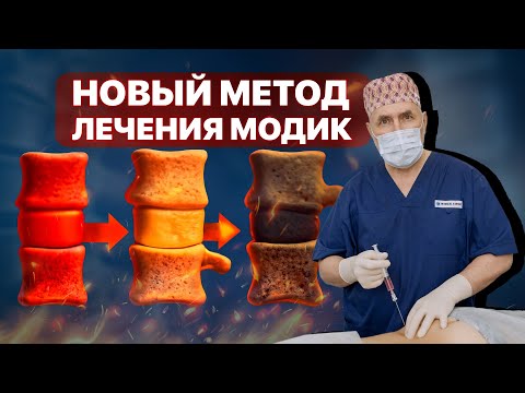 Модик лечится: эффективно убираем отёк костного мозга и боль | Профессор Евгений Соков