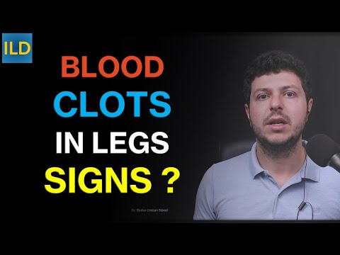 Blood clots in the legs - recognize the signs and risk