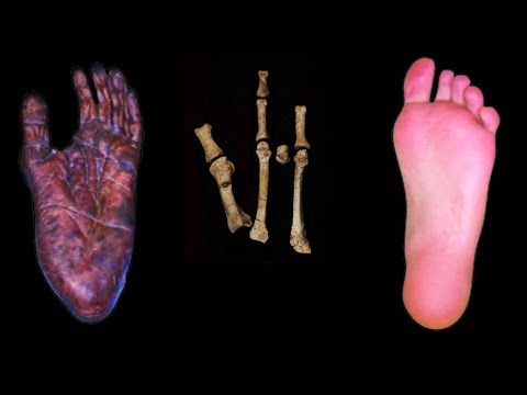 Scientists finally solved the Burtele Foot Mystery