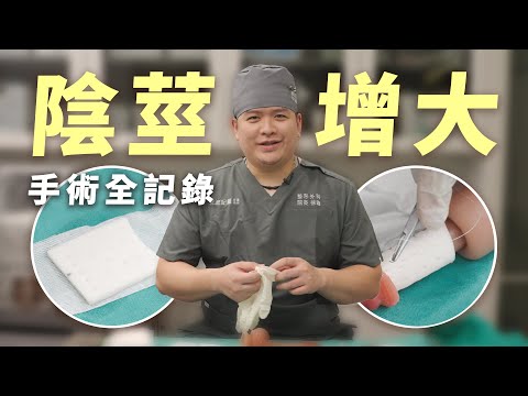【增大實境秀】1比1真人比例,最真實的陰莖增大術手術全記錄|徐詣整形外科醫師