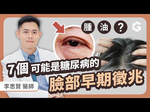 糖尿病7個臉部早期徵兆？可能是血糖失控警訊｜初日診所 李思賢 思思醫師（⚠️超過3個，請儘速抽血檢查）