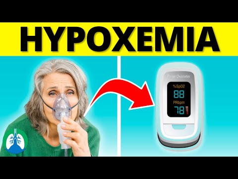 Hypoxemia | Causes, Symptoms, Diagnosis, and Treatment