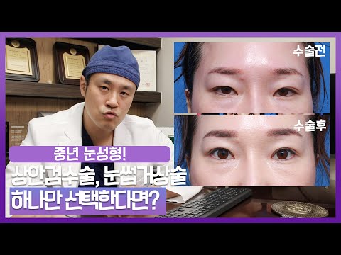 중년 눈성형 상안검수술, 눈썹하거상술 하나만 택한다면?