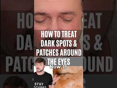 WATCH Dark Circles & Skin Spots Disappear