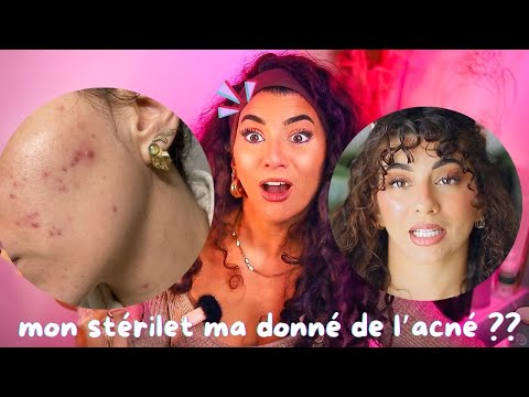 stérilet & acné = update