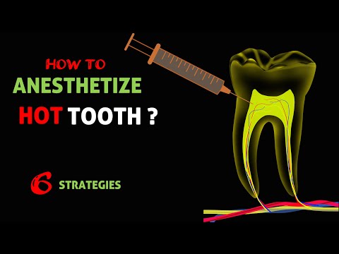 How to Anesthetize hot tooth