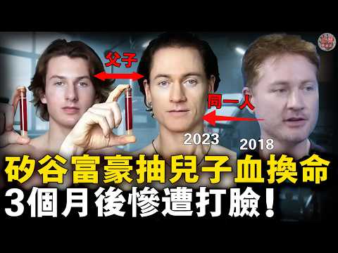 起底矽谷抗衰騙局：富豪砸錢嗑藥換血，卻差點被神藥送走😱背後產業鏈賺麻了！【迷霧調查組】 富豪八卦 名人故事 社會奇聞