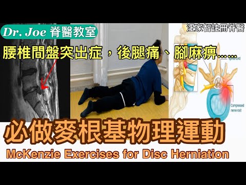 腰椎間盤突出症、腳麻痹、坐骨神經痛症又不想做手術，怎樣辦？教大家麥根基物理療法［Eng Subtitles ]McKenzie Method Exercises for Disc Herniation