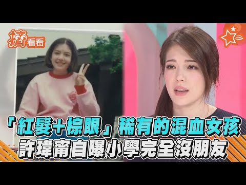 「紅髮+棕眼」稀有的混血女孩　許瑋甯自曝小學完全沒朋友｜TVBS新聞｜擠看看
