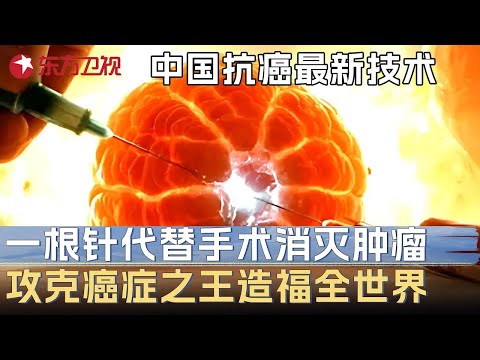 中国发布抗癌最新技术! 用一根针代替手术彻底消灭肿瘤, 攻克癌症之王造福全世界 #未来说执牛耳者 第五季 第6集 FULL