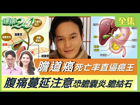 膽道癌死亡率直逼癌王！右上腹痛蔓延肩膀.後背 小心膽囊炎！無肉不歡長5千顆膽結石 黑白結石大不同！中醫排石茶助排小石！暢管茶防膽發炎！ 健康2.0 20220918 (完整版)