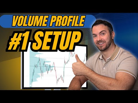 My #1 Volume Profile Setup (Step-by-Step)