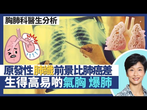 方大同41歲離世！醫生拆解肺纖及氣胸健康疑慮｜原發性肺部纖維化前景比肺癌差？生得高較易患氣胸爆肺？肺纖令肺部縮細 無法逆轉但不治療會不斷惡化！｜王建芳醫生 胸肺科醫生譚子雋醫生｜人類健康研究所