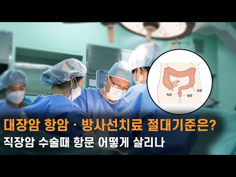 대장암 항암ㆍ방사선치료 절대기준은? 직장암 수술때 항문 어떻게 살리나