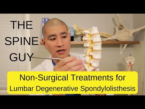 Non-Surgical Treatments for Lumbar Degenerative Spondylolisthesis - Part 2