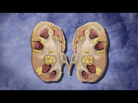 The Body After Drinking A Snowglobe