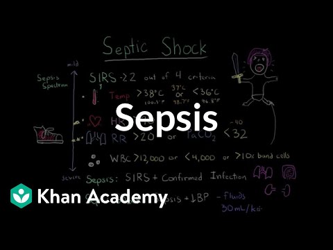 Sepsis: Systemic inflammatory response syndrome (SIRS) to multiple organ dysfunction syndrome (MODS)