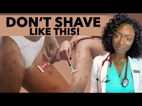 These SHAVING MISTAKES Are Damaging Your Skin | Avoid Razor Burn, Ingrown Hair, Irritation