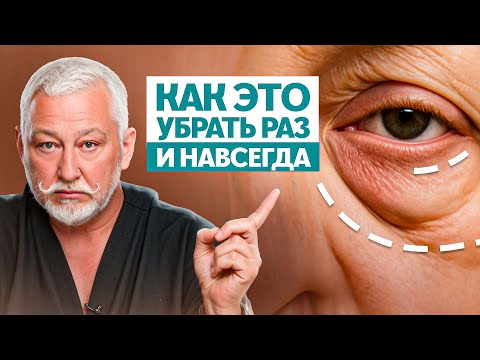 Отеки и мешки под глазами. Скрытые причины и 3 неожиданных решения