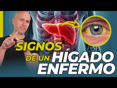 Signos de que tu HÍGADO está enfermando (EXPLICADO)
